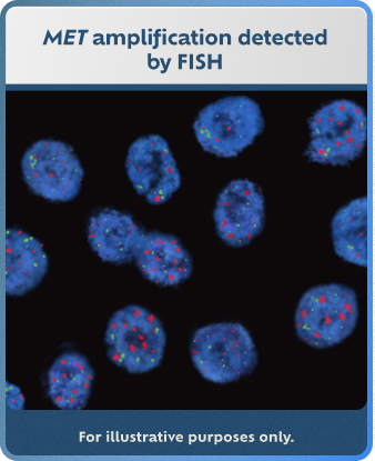 FISH detection method example (for illustrative purposes only).