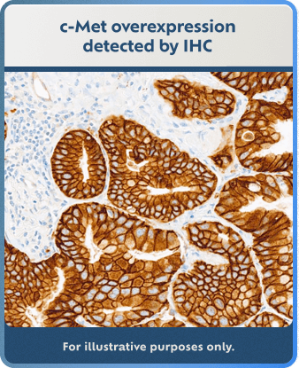 IHC detection method example (for illustrative purposes only).