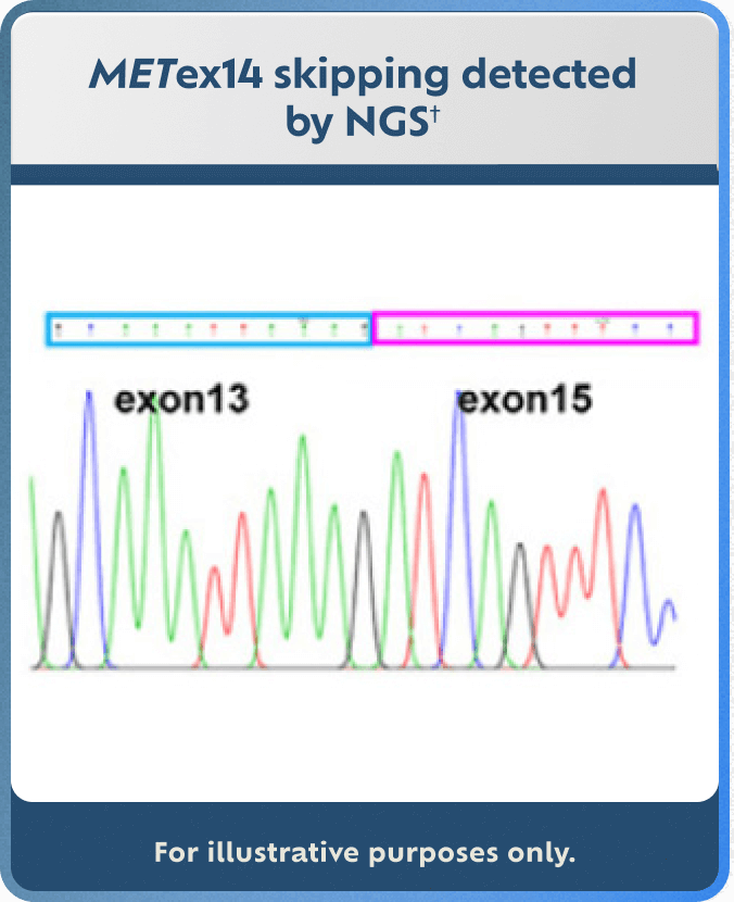 NGS detection method example (for illustrative purposes only).