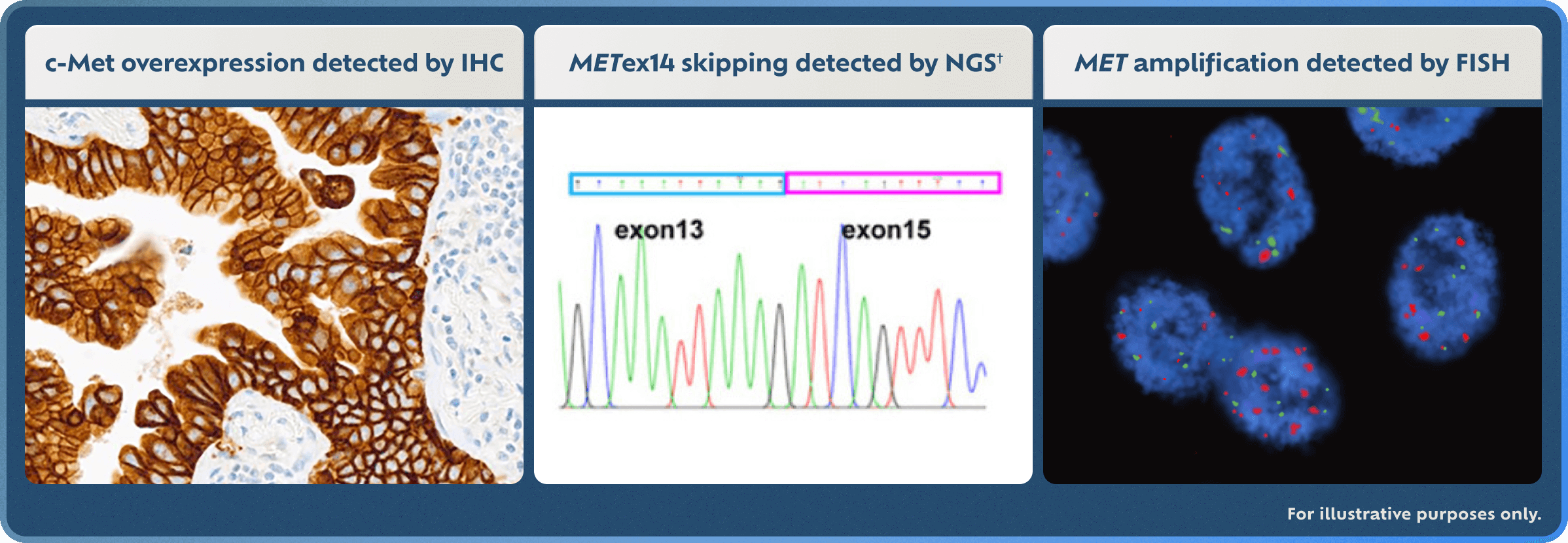 MET Detection methods: IHC, NGS and FISH (for illustrative purposes only).